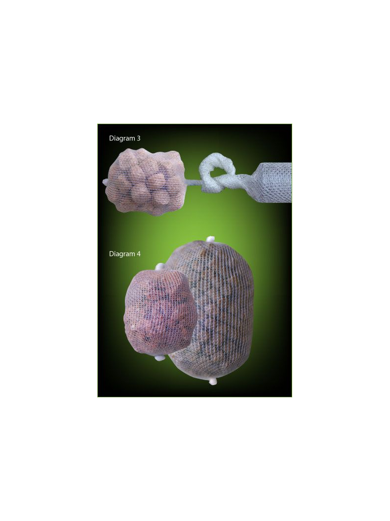 ПВА сетка ESP PVA Mesh Kit с плунжером или с воронкой, Диаметр: 25 мм, изображение 11 ПВА сетка ESP PVA Mesh Kit с плунжером или с воронкой, Диаметр: 25 мм, изображение 11